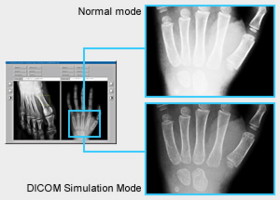  DICOM Simulation