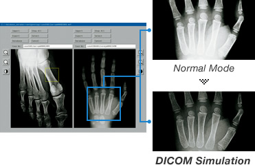  DICOM Simulation